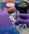 Russian Scientists Develop Blood Test for Early Breast Cancer Detection