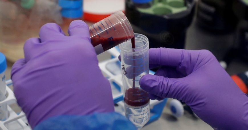 Russian Scientists Develop Blood Test for Early Breast Cancer Detection