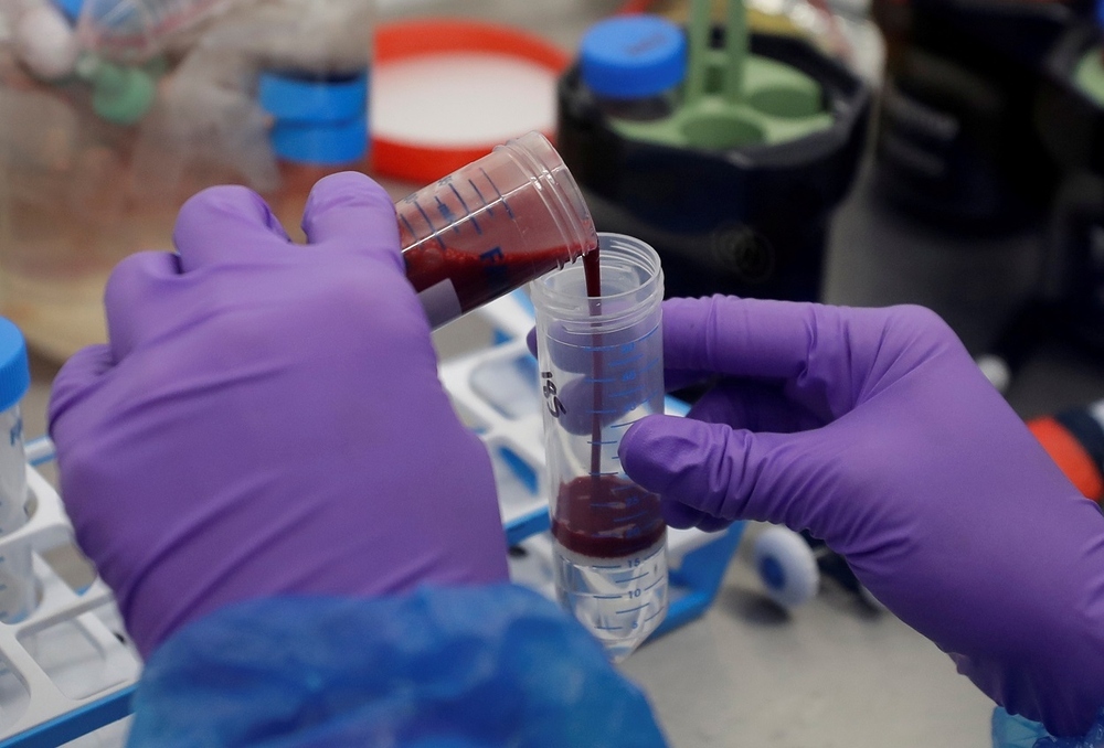 Russian Scientists Develop Blood Test for Early Breast Cancer Detection 3 64357 moi393188563